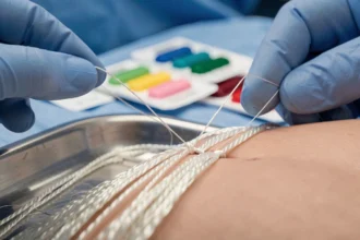 Gros plan sur un fil de suture résorbable tenu par une main gantée lors d'une procédure chirurgicale, comparaison de matériaux sur plateau stérile